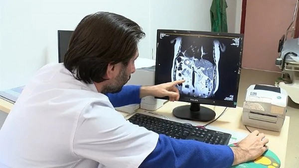 Türkiye’de ikinci vaka! Doktorları bile şoke etti: İlk defa görünce şaşırıyorlar…